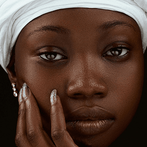 Preenchimento Facial